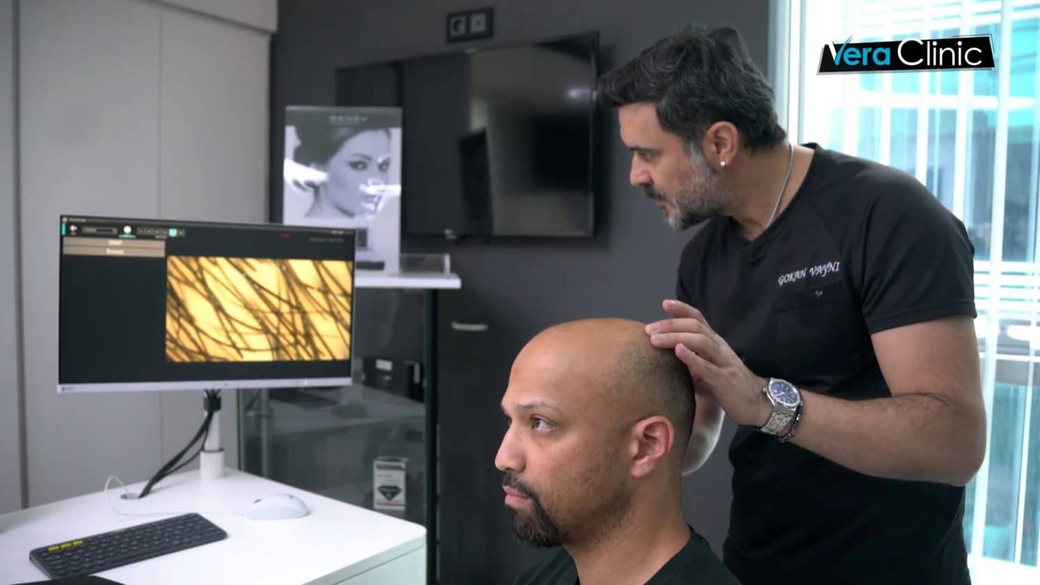 Why Men Are Opting for Local Surgeons Over Travel for Hair Transplants